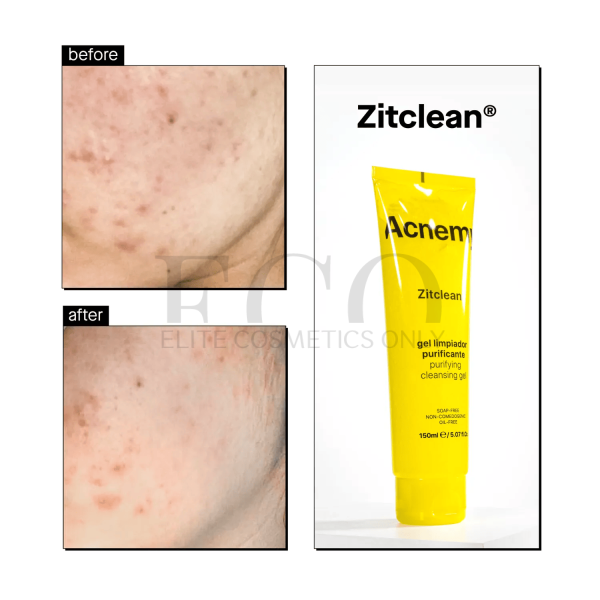 Очищуючий гель Acnemy Zitclean Purifying Cleansing Gel, 150 мл
