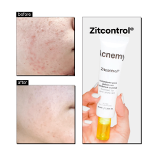 Крем для проблемной кожи Acnemy Zitcontrol Moisturizer, 40 мл