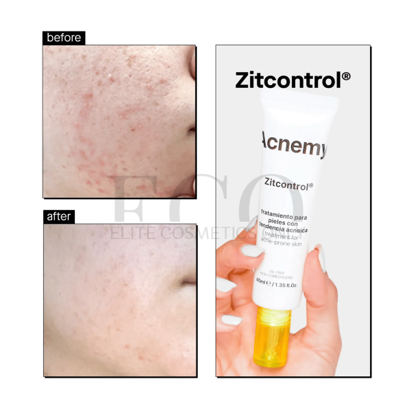 Крем для проблемної шкіри Acnemy Zitcontrol Moisturizer, 40 мл
