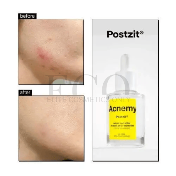 Сироватка від висипань Acnemy Postzit, 30 мл